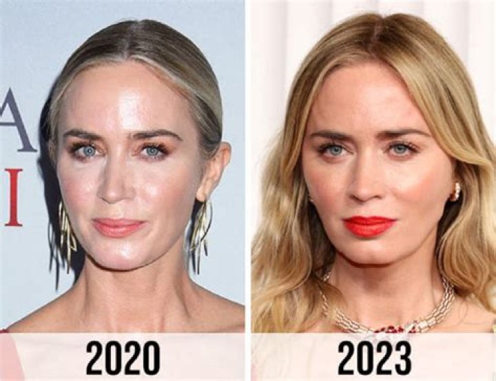 Emily Blunt Botox And Nose Job | Did She Underwent Surgery